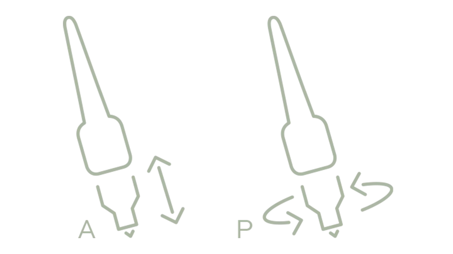 A and P system